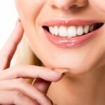 How Much Do Veneers Cost? A Comprehensive Guide